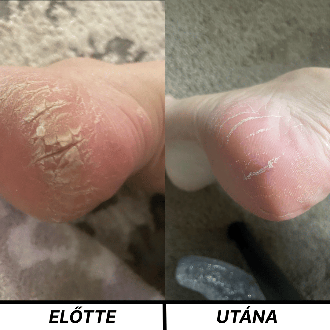 Silena®-Pure Glide