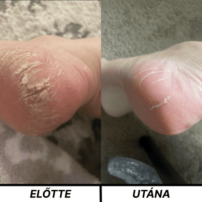 Silena®-Pure Glide